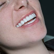 Slider image (9) Turkiye Dental